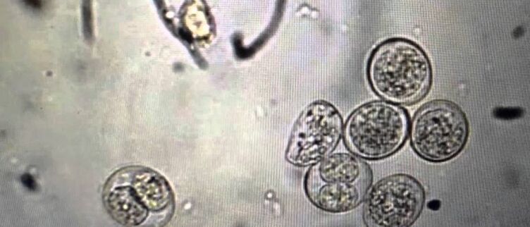 celule parazitare protozoare